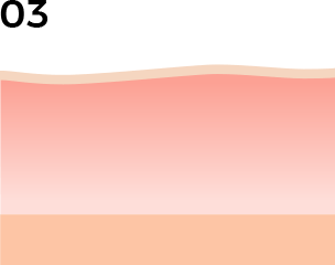 ダーマペンのメカニズム