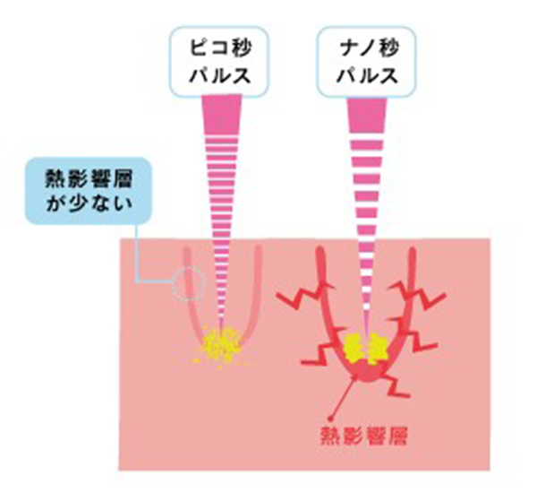 治療方法について