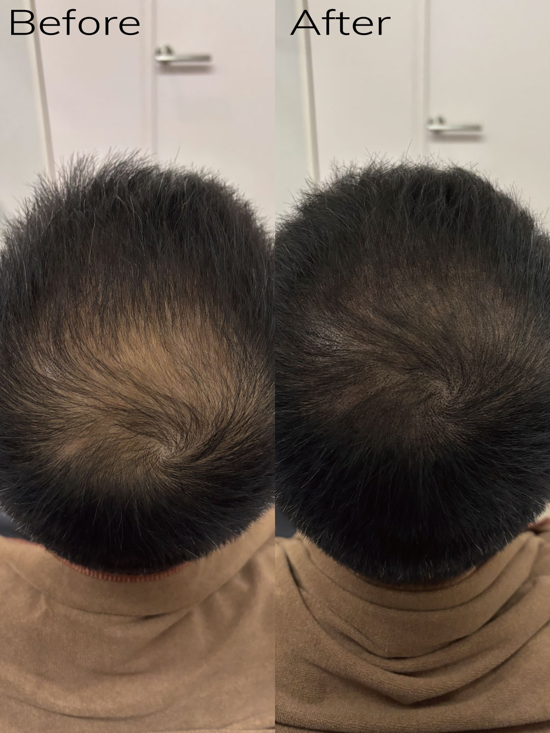 好原 症例6