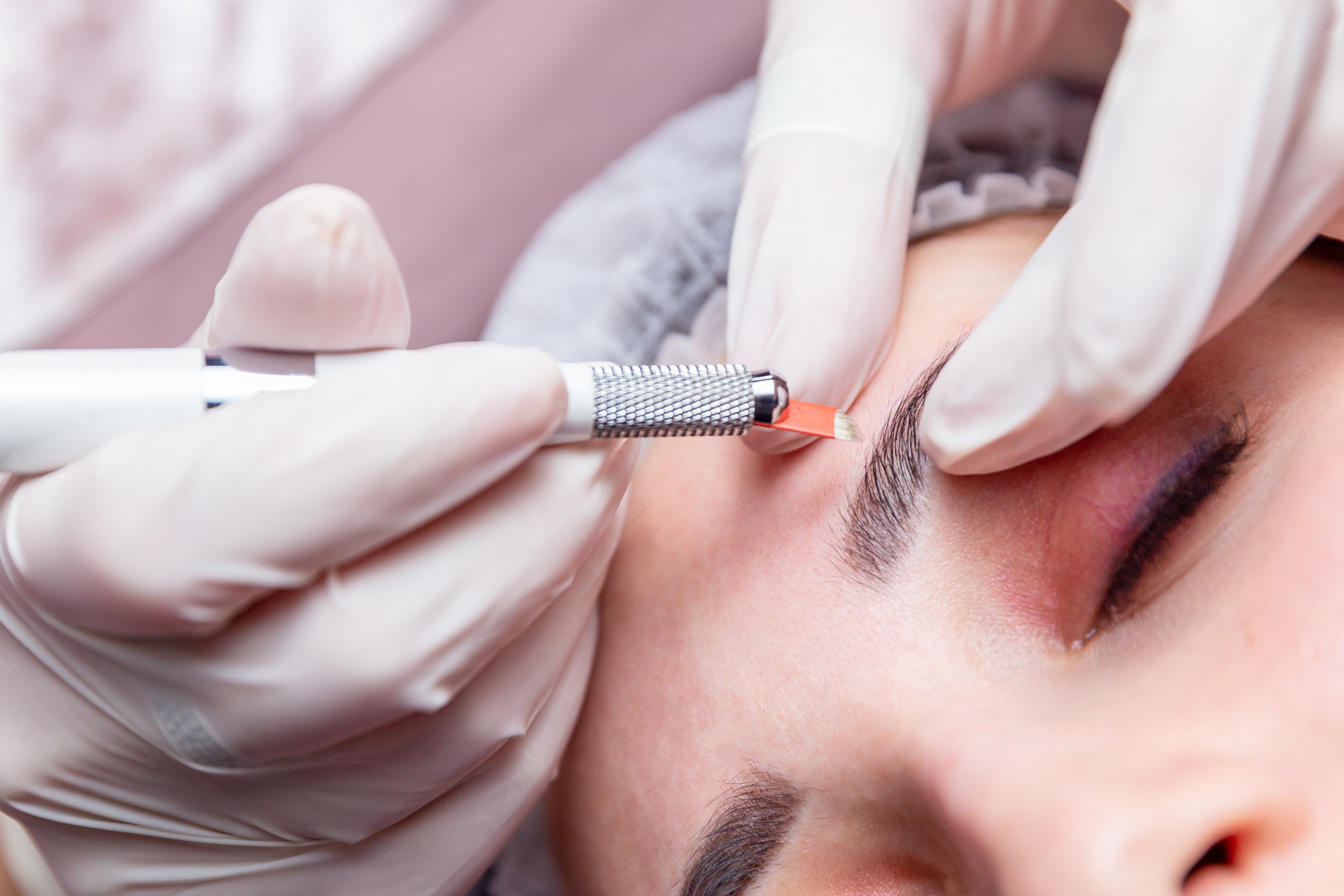 医療アートメイクとは