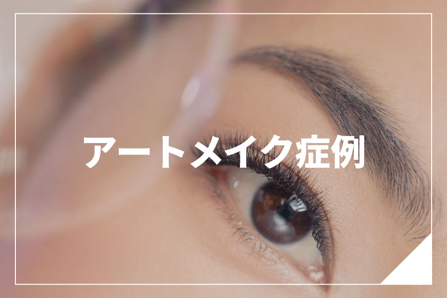 症例