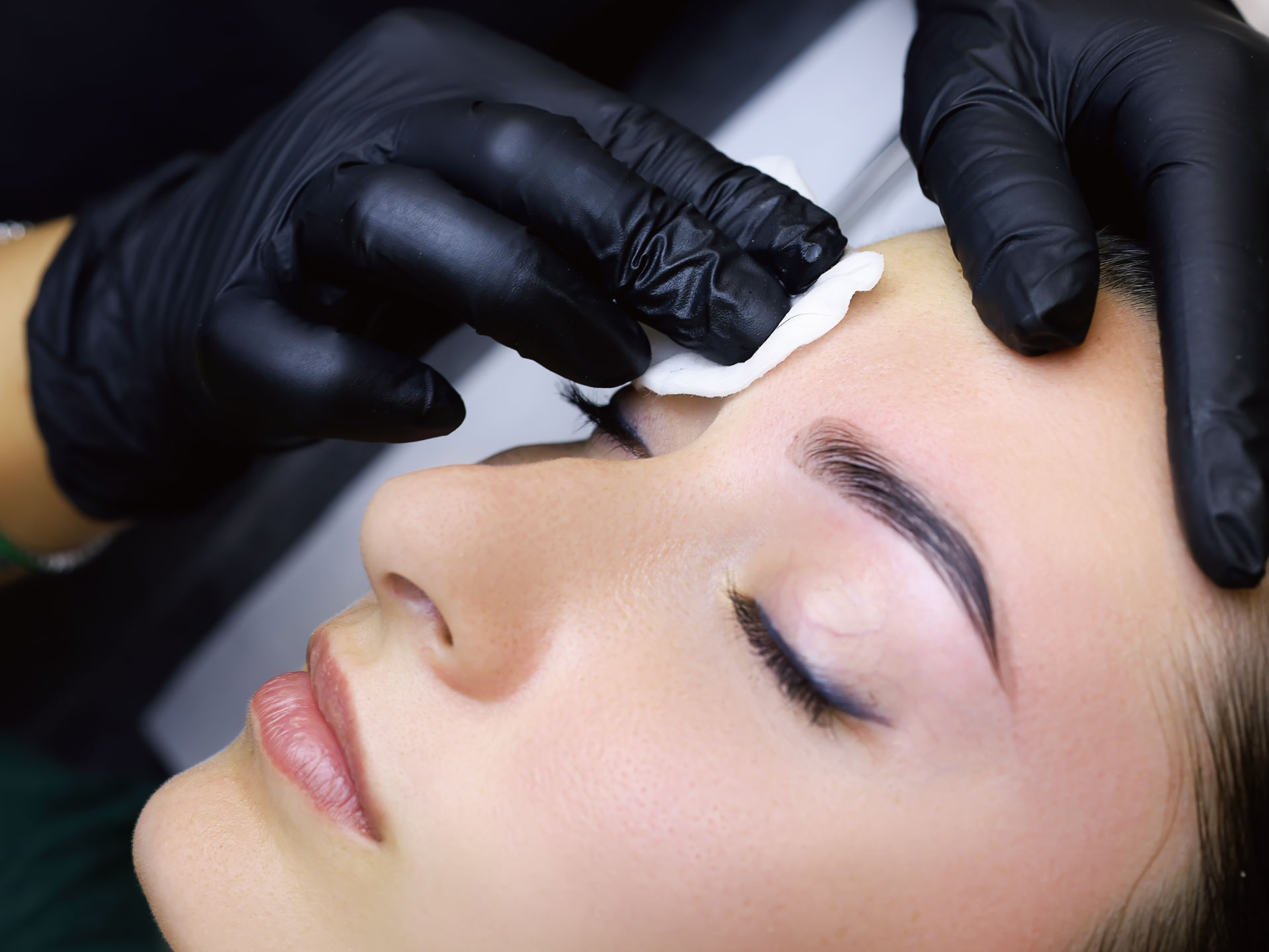 治療方法について